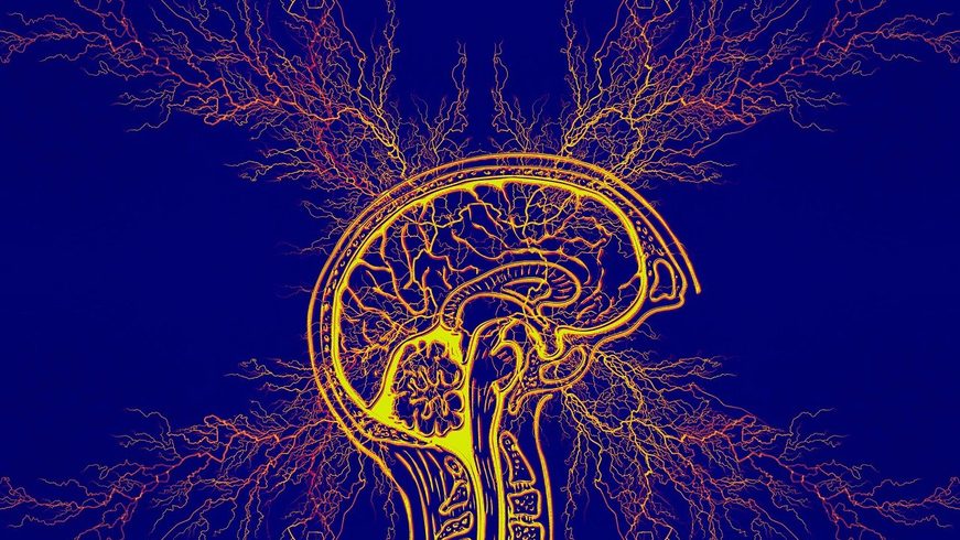 Image d'un infrarouge d'un cerveau
